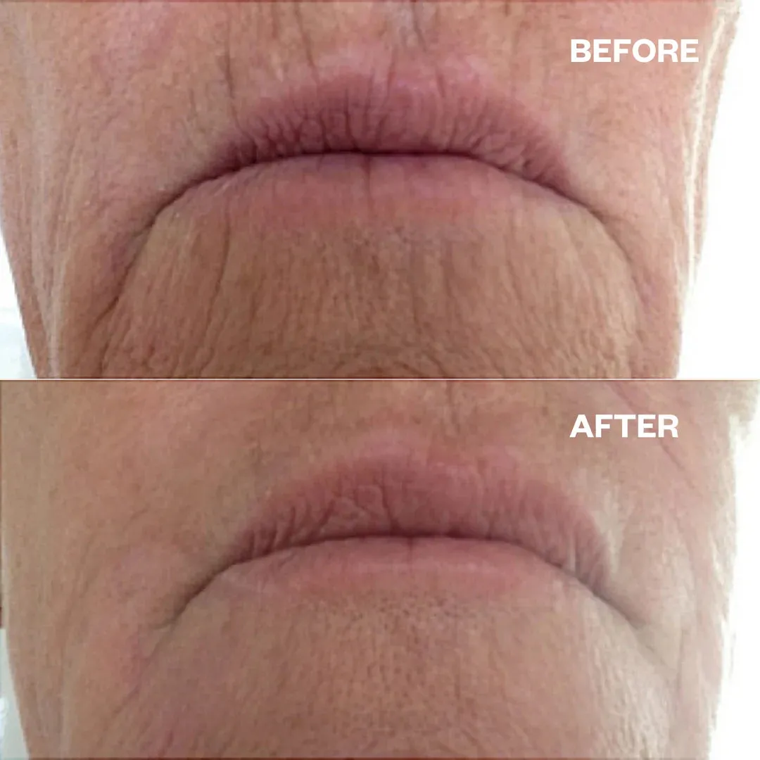 3-Step Mouth & Lip Renewal Pack